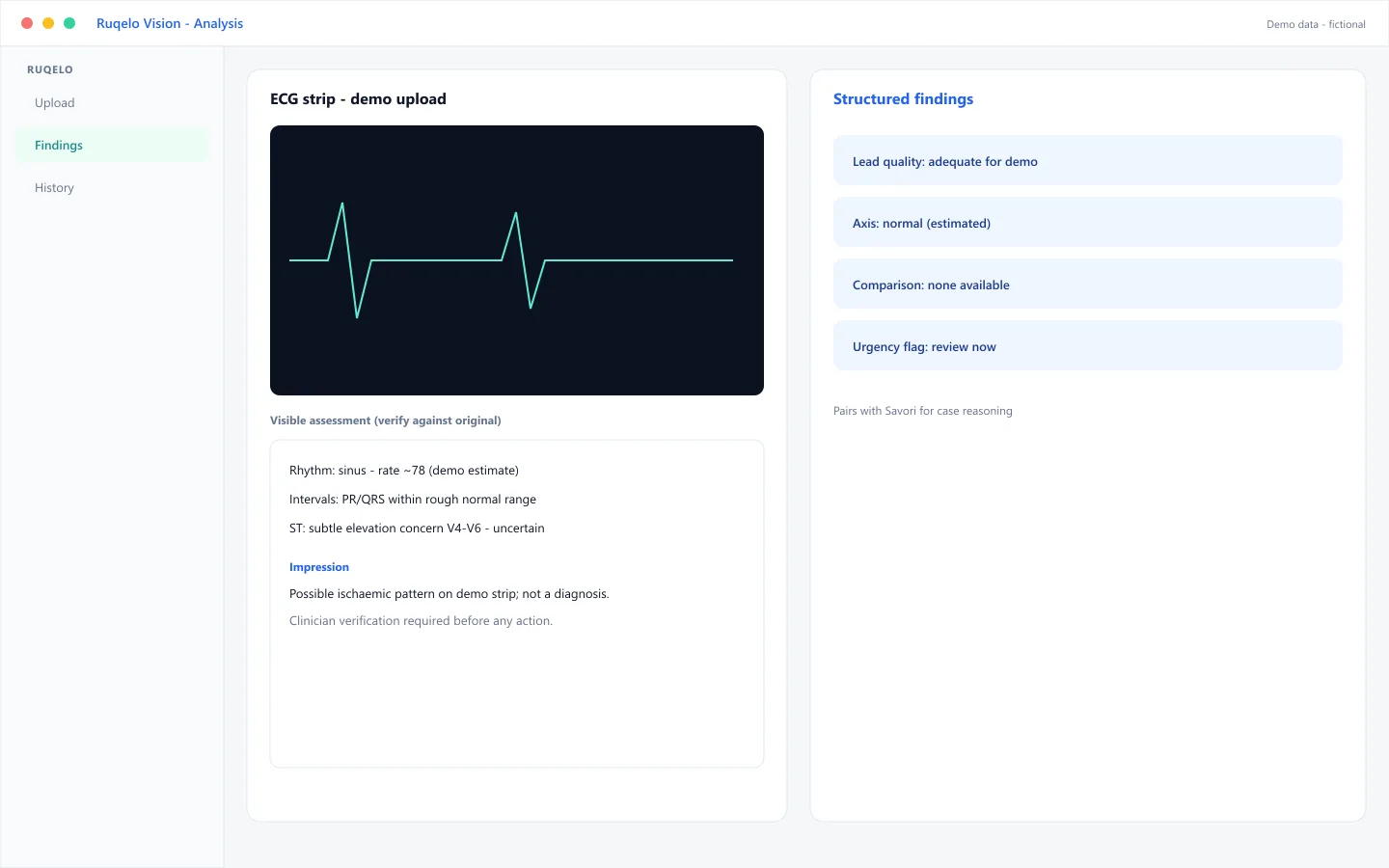 Demo Ruqelo Vision analysis of a synthetic ECG strip with structured findings and verification disclaimer