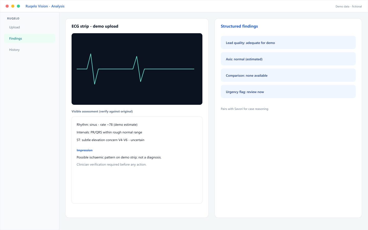 Demo Ruqelo Vision analysis of a synthetic ECG strip with structured findings and verification disclaimer